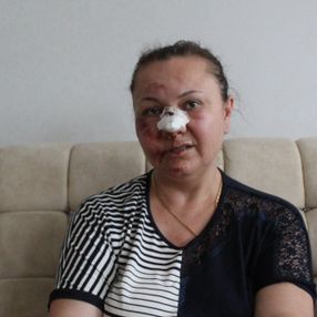 Gaziantep'te eski erkek arkadaştan şiddet