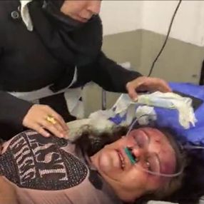 Sancaktepe’de Suriyeli anne ve kızı darbedip ziynet eşyalarını çaldılar