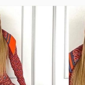 Demet Akalın Versace takımıya poz verdi