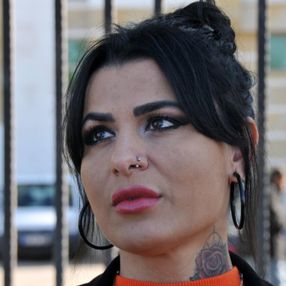 Antalya'da lazerde yüzü yanan kadının davasında sonuç çıktı