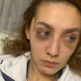 Gaziosmanpaşa'da eşofman yüzünden terk edilen kadın darbedildi