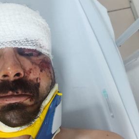 Aydın'da kamyon şoförü parke taşıyla darbedildi