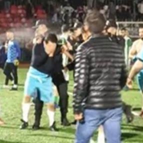 Bartın'da iki takım futbolcuları arasında kavga çıktı