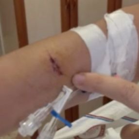 Elazığ'daki doktor, kız arkadaşını öldüresiye dövdü