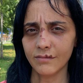 Zonguldak'ta bir kadın, tanımadığı şahsın saldırısına uğradı