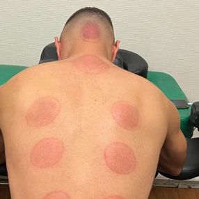 Karim Benzema hacamat yaptırdı