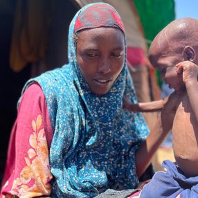 Somali'de milyonlarca insan açlık ve kuraklıkla mücadele ediyor