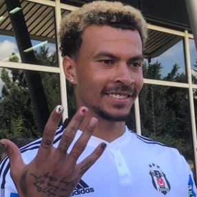 Dele Alli'nin yeni ojeleri