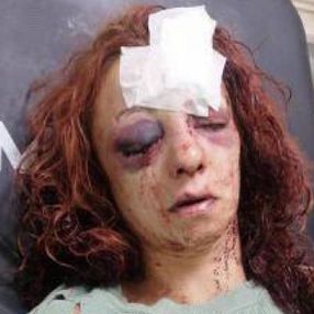 Mersin'de kıskançlık krizi: Genç kadını öldüresiye dövdü