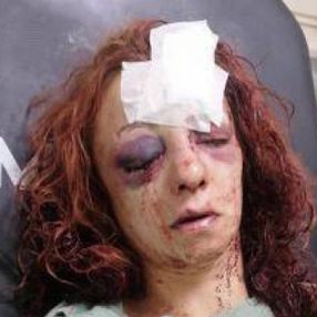 Mersin’de kıskançlık nedeniyle dövülen kadın yoğun bakımdan çıktı