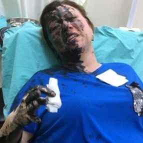 Adana'da darbedilen müteahhit hastaneye kaldırıldı