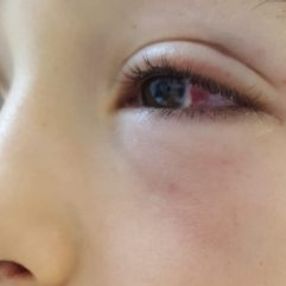 Oğluyla tartışan 9 yaşındaki çocuğu yumrukla dövdü