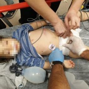 Üvey annenin komaya soktuğu küçük kıza devlet sahip çıktı