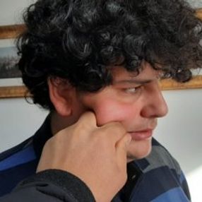 Yanaktan makas almak tazminat sebebi sayıldı