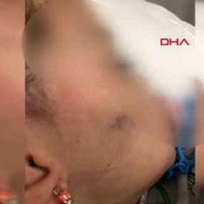 Anaokulunda işkence iddiası