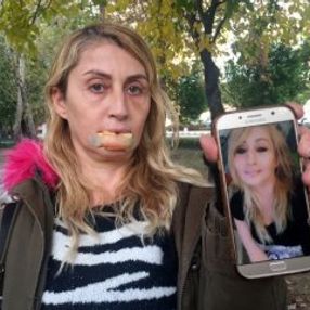 Güzellik uğruna hayatı karardı