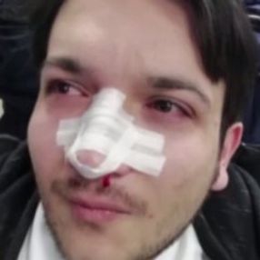 Doktorun burnunu kıran şüpheli teslim oldu