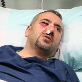 Kahramanmaraş’ta bir sağlık teknikeri saldırıya uğradı