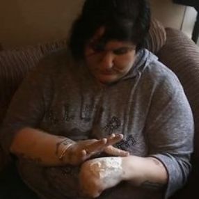 İngiltere'de yaşayan kadın 15 yıldır bebek pudrası yiyor