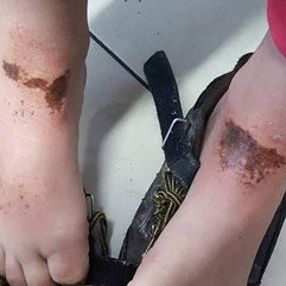 Kar topu oynayan çocukları yakan madde bulundu