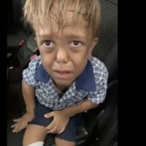 Cüce diye aşağılanan 9 yaşındaki çocuğa ünlülerden destek