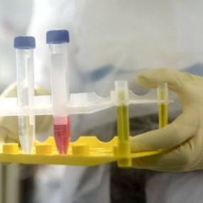 Oxford Üniversitesi, aşı çalışmalarını hızlandırdı