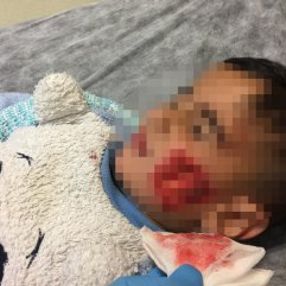 Şanlıurfa'da sokak köpekleri 6 çocuğa saldırdı