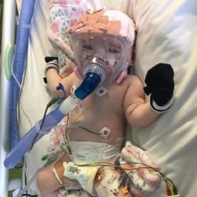 İngiltere'de altı aylık bebek, koronayı yenmeyi başardı