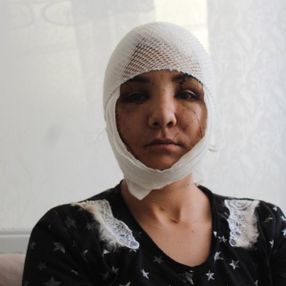 6 yıllık eşi tarafından yüzünden bıçaklandı