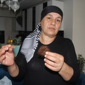 Kızının saçlarını gösterdi: Sürekli dayak yiyordu