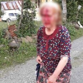 Ordu'da bir kişi yengesini balta ile yaraladı