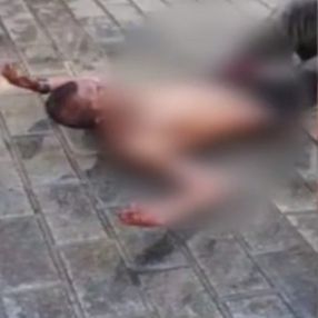 Taksim’de, ağabey kardeşini tinerle yaktı