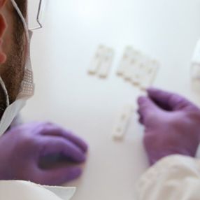 ZET Medikal, koronavirüsü 15 dakikada tespit eden antikor test kiti geliştirdi