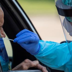ABD'de 150 milyon adet koronavirüs test kiti alınacak
