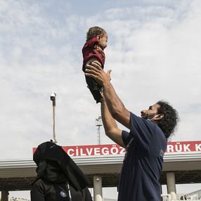 Uzuvları olmayan İdlibli Muhammed bebek, tedavi için Türkiye'de