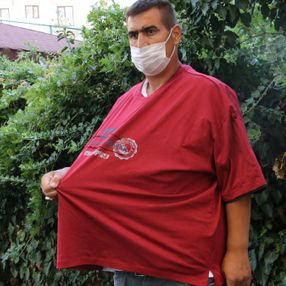 Ankara’da bir kişi 7 ayda 150 kilo verdi