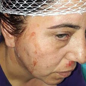 Afyonkarahisar'da annesini ziyarete gitti, akrabaları darbetti