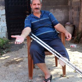 Adana’da sigara yüzünden bacağını kaybeden adam: Beni ibret alın