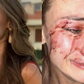 İzmir’de darbedilen Ukraynalı model, özrü kabul etti