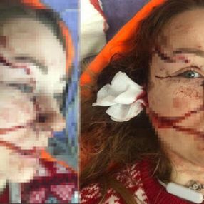 İstanbul’da eşinin falçatalı saldırısına uğradı: Yaşamak istiyorum