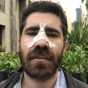 Kadıköy'de, aile hekimi sokak ortasında darbedildi