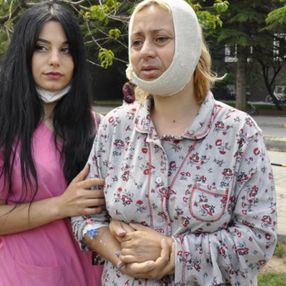 Eskişehir’de hayvanları beslerken darbedildi: Çenemde kırık var, platin takıldı