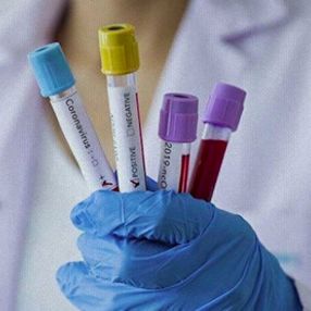 Koronavirüsün kökeni, 20 bin yıl önceye dayanıyor