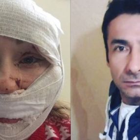 Bakırköy'de boşanmak istediği eşi tarafından falçatalı saldırıya uğrayan kadın konuştu