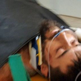 Kaz Dağları'nda çıkan yangına müdahale eden orman gönüllüsüne, ayı saldırdı
