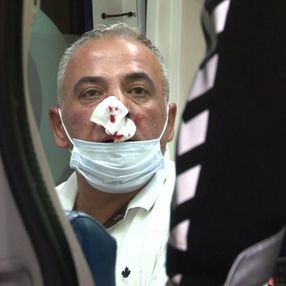 İstanbul'da kazaya sebep olan alkollü sürücü dayak yedi