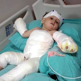 İzmir'de yaşayan genç kadın ve oğlu, cezaevinden çıkan eşi tarafından yakıldı