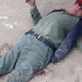 Sakarya'da yaşlı adam sokak köpeklerinin saldırısına uğradı