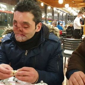 Kendini vuran Ahmet’in tek hayali normal insanlar gibi yaşamak