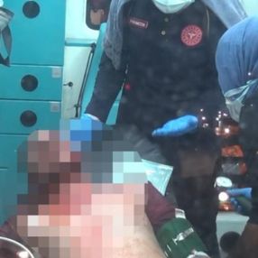 Adana'da bir kişi tabanca kabzasıyla öldüresiye darbedildi